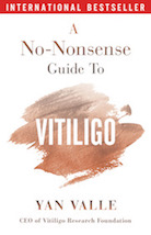 latest vitiligo research