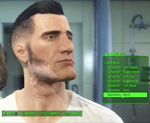 Fallout 4 Video Game Vitiligo