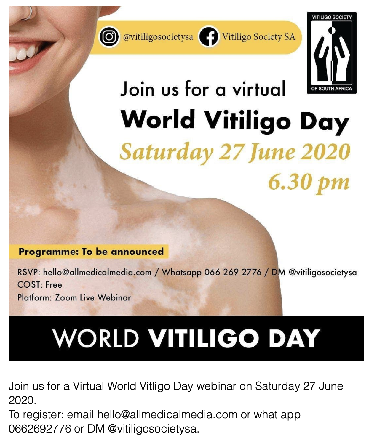 World Vitiligo Day 2020 - South Africa