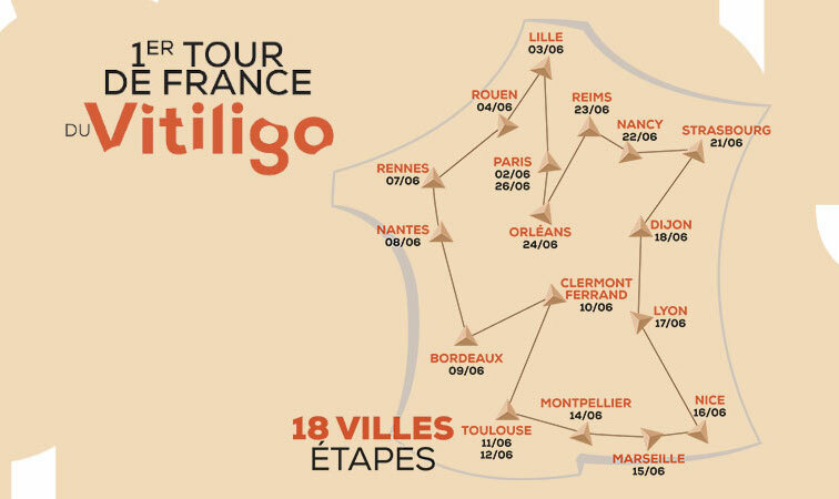 Vitiligo Tour de France