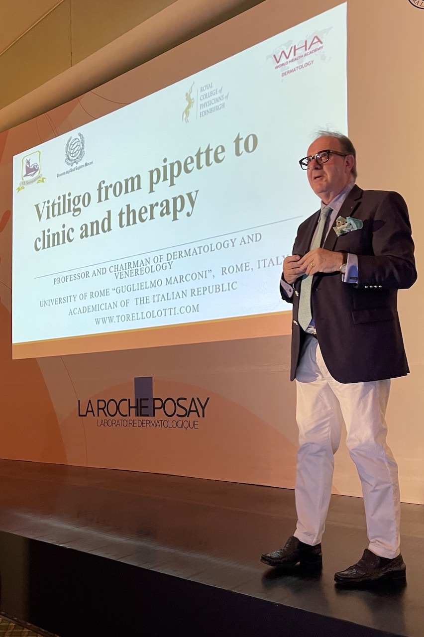 World Vitiligo Day 2022 Prof. Torello Lotti
