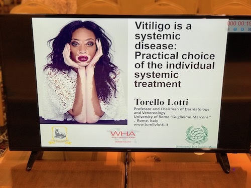 Vitiligo_Iaşi_Winnie_Harlow