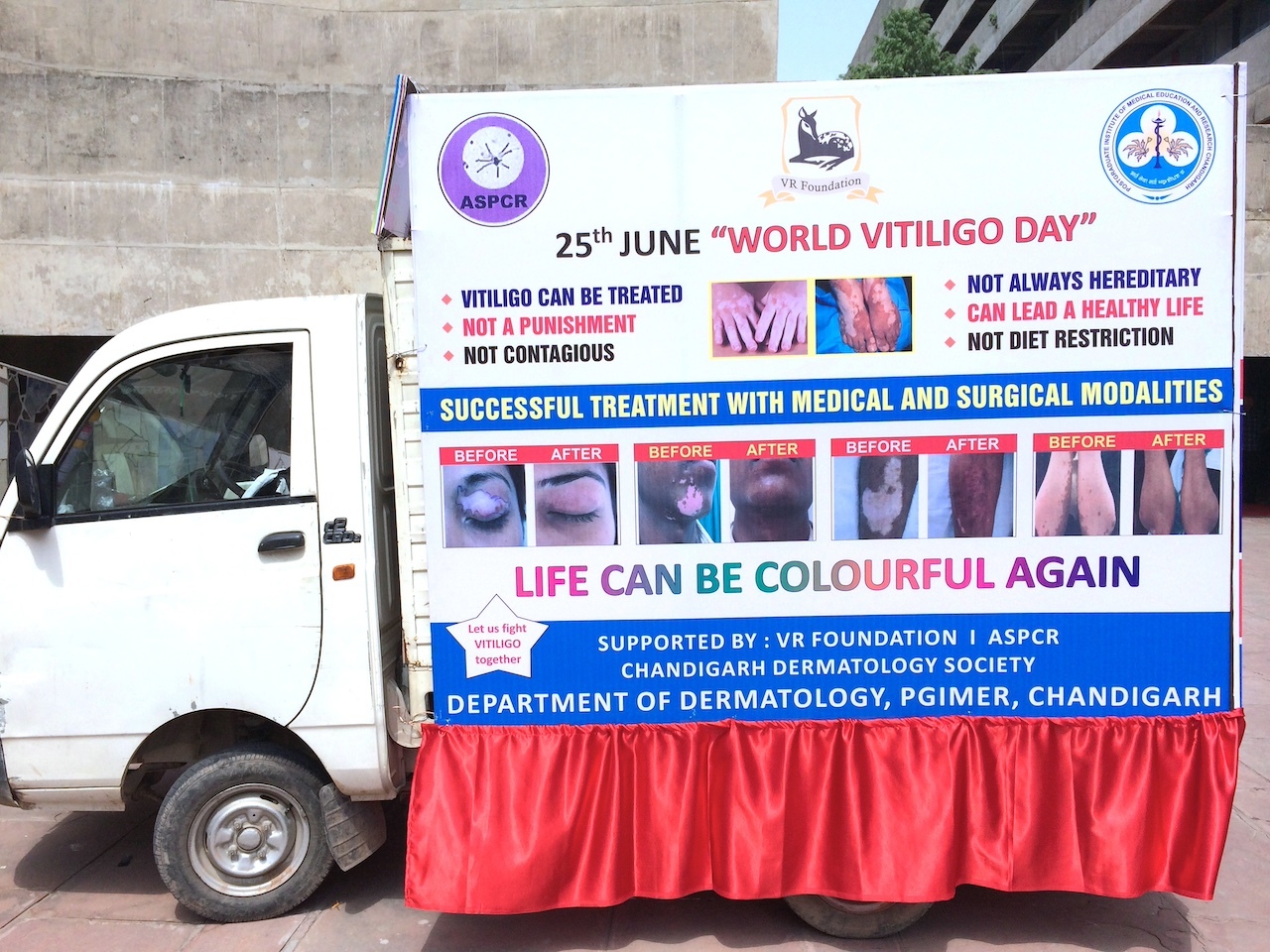 World Vitiligo Day 2014 - India - 8