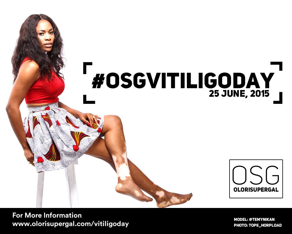 World Vitiligo Day 2015 OSG