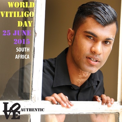 World Vitiligo Day 2015 - South Africa