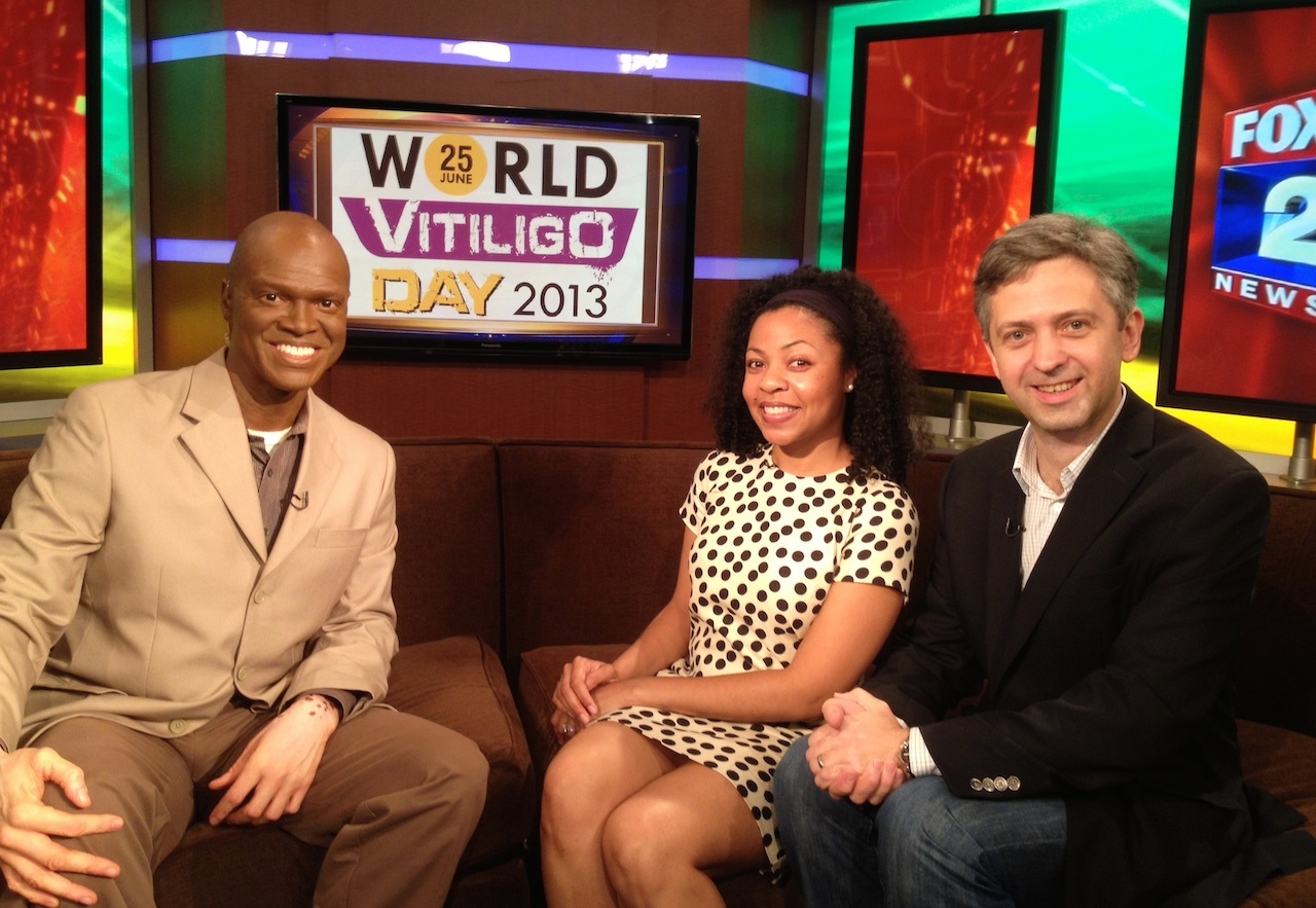 World Vitiligo Day 2013 - Fox 2 TV - Lee Thomas Masha Henrdeson and Yan Valle