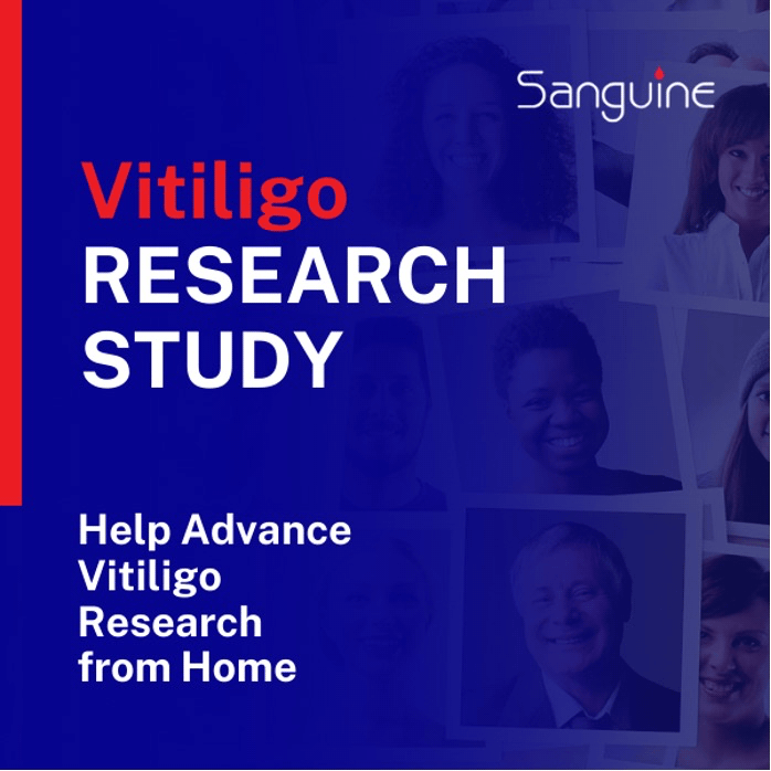 Sanguine Bio vitiligo study