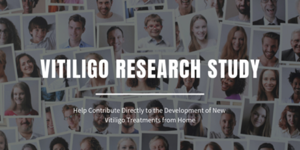 Vitiligo_Sanguine_study